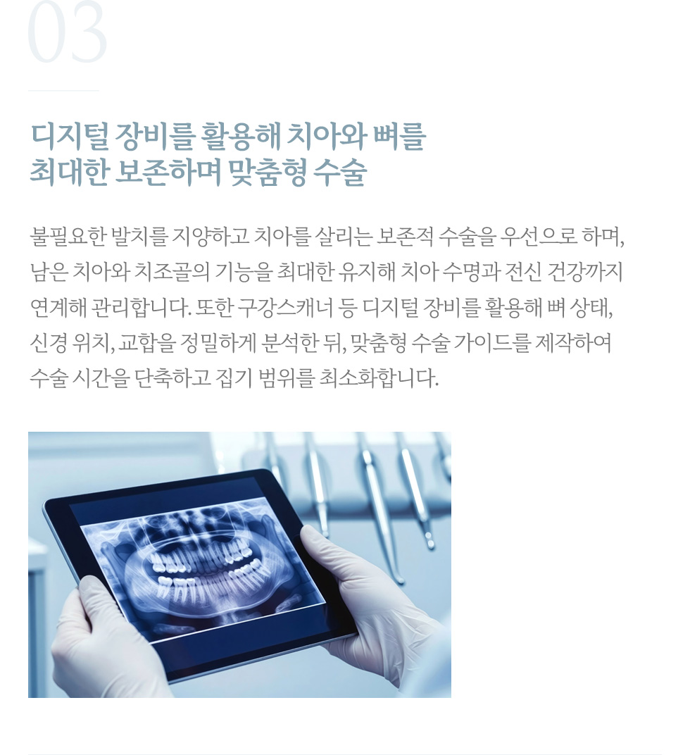 디지털 장비를 활용해 치아와 뼈를 최대한 보존하며 맞춤형 수술