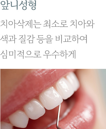 앞니성형