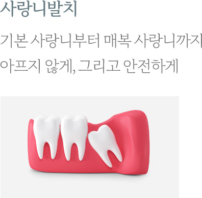 사랑니발치
