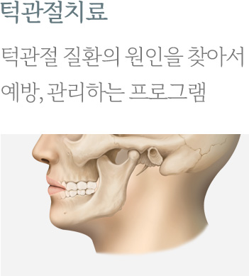 턱관절치료