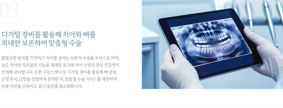 디지털 장비를 활용해 치아와 뼈를 최대한 보존하며 맞춤형 수술