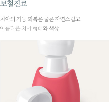 보철진료