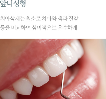 앞니성형