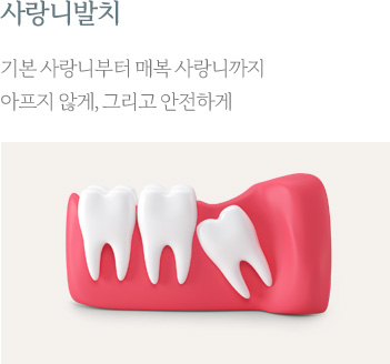 사랑니발치
